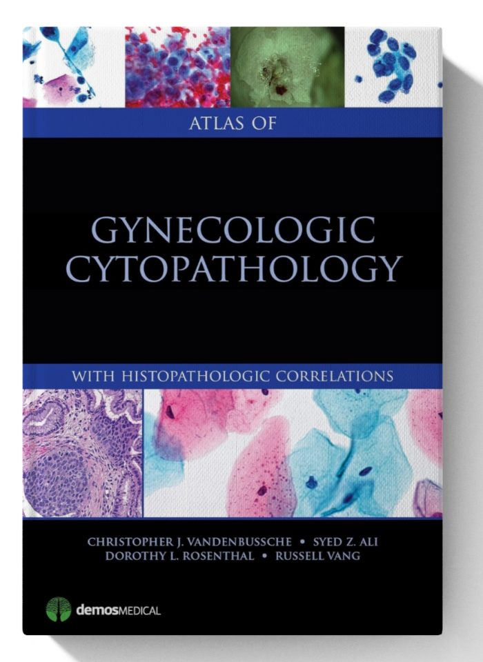 Atlas of Gynecologic Cytopathology: with Histopathologic Correlations