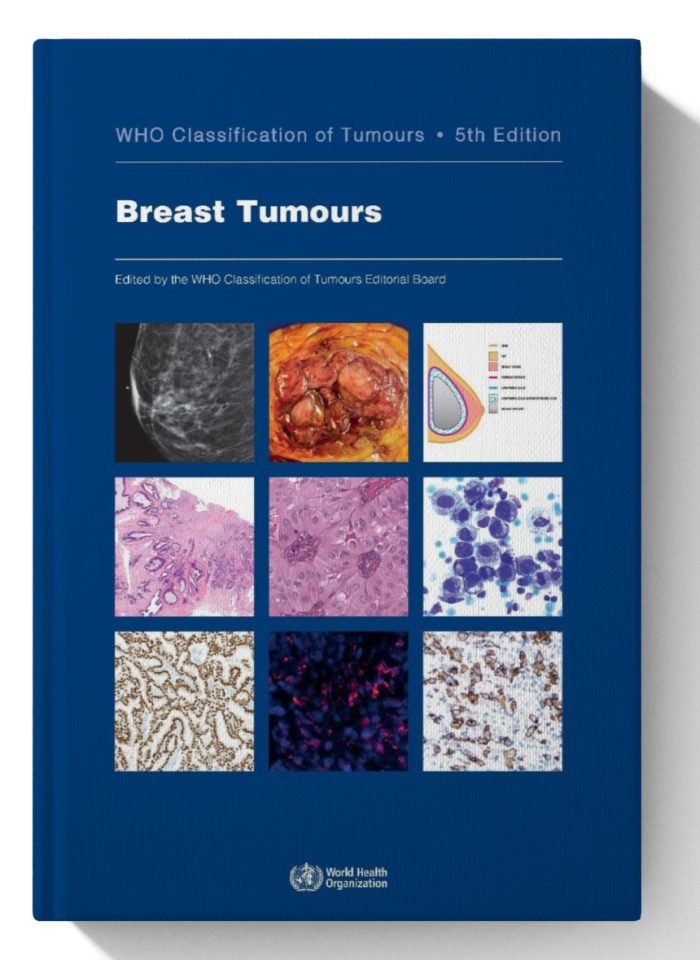 Breast Tumours: WHO Classification of Tumours (Medicine)