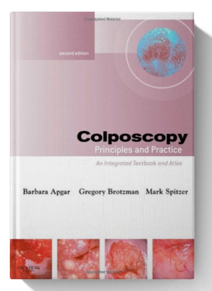 Colposcopy: Principles and Practice: An Integrated Textbook and Atlas