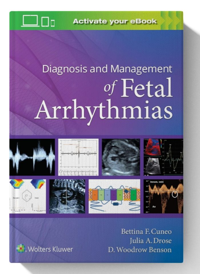 Diagnosis and Management of Fetal Arrhythmias