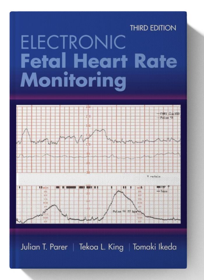 Electronic Fetal Heart Rate Monitoring: The 5-Tier System: The 5-Tier System