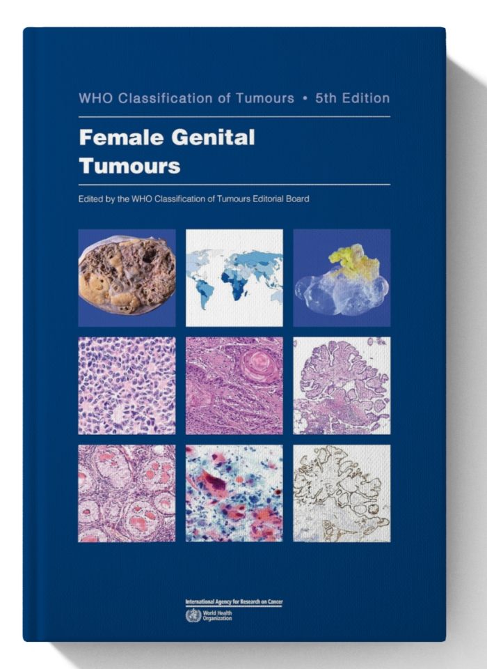 Female Genital Tumours: WHO Classification of Tumours (Medicine)