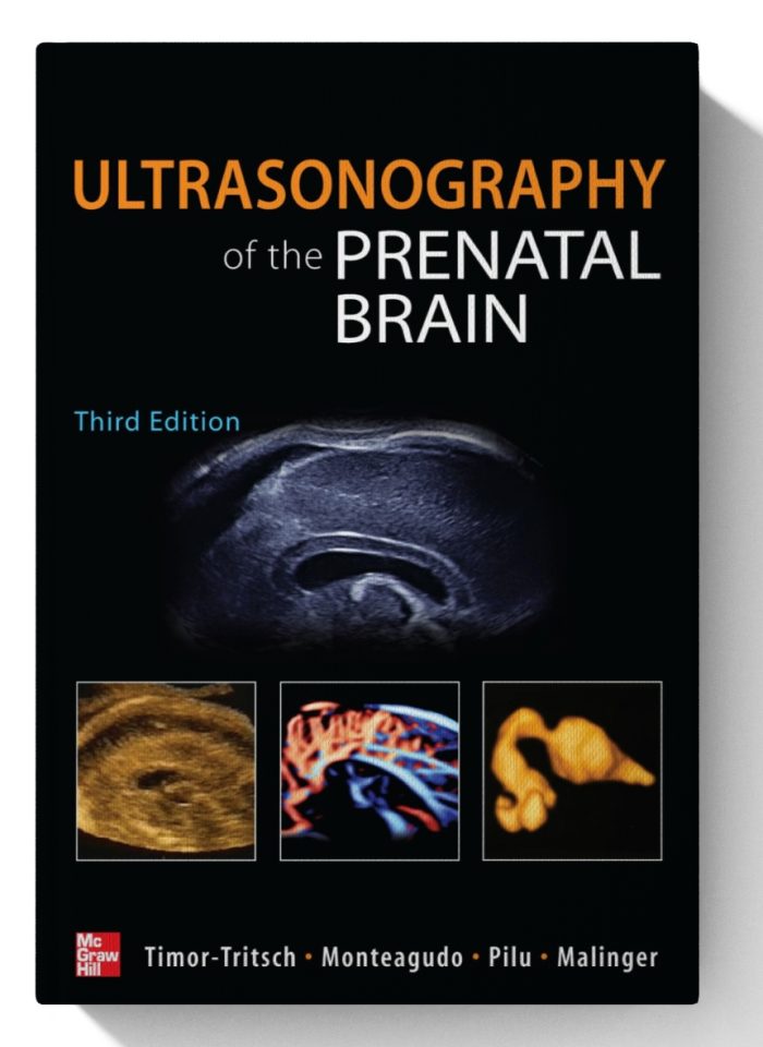 Ultrasonography of the Prenatal Brain, Third Edition