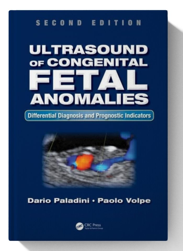 Ultrasound of Congenital Fetal Anomalies: Differential Diagnosis and Prognostic Indicators, Second Edition