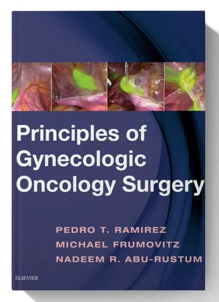 Principles of Gynecologic Oncology Surgery (1st Edition)