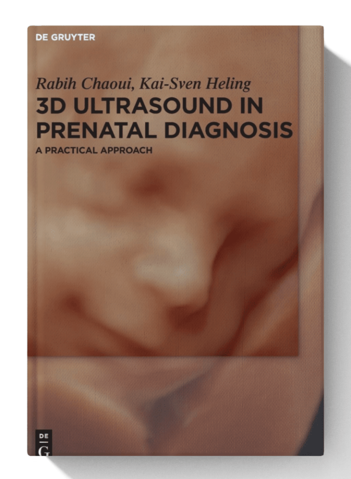 3D Ultrasound in Prenatal Diagnosis: A Practical Approach