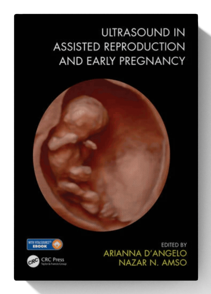 Ultrasound in Assisted Reproduction and Early Pregnancy (1st Edition)