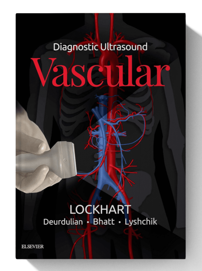 Diagnostic Ultrasound: Vascular 1st Edition