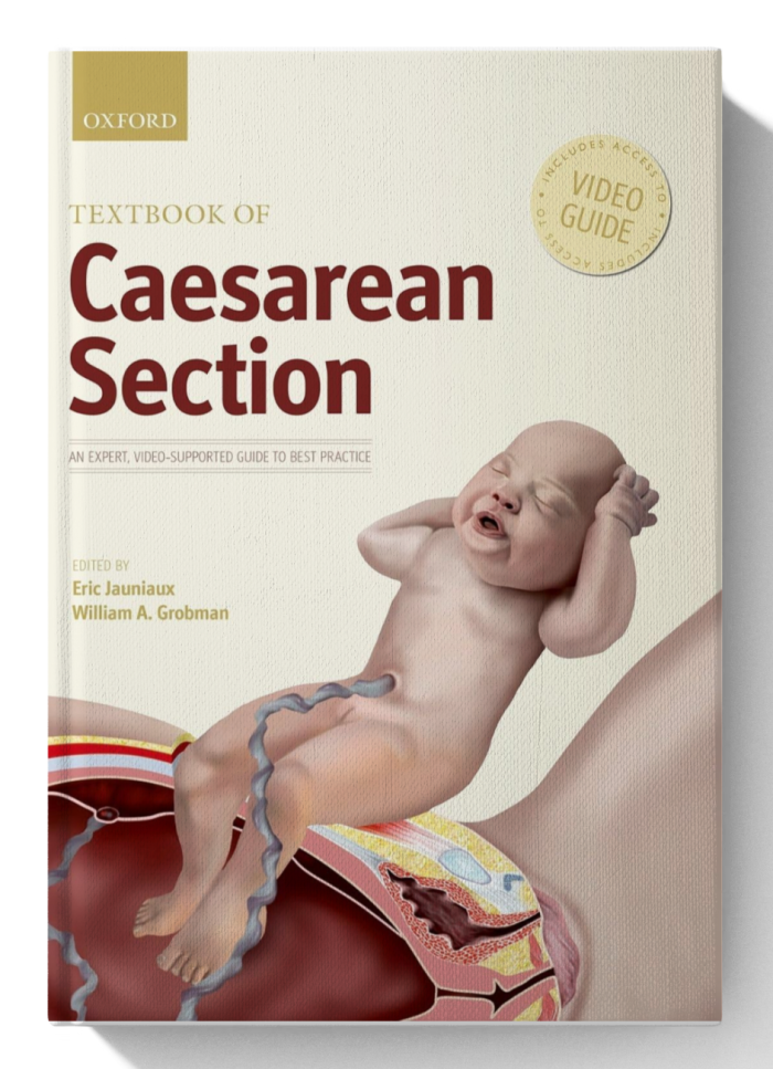 Textbook of Caesarean Section 1st Edition (Videos not included)