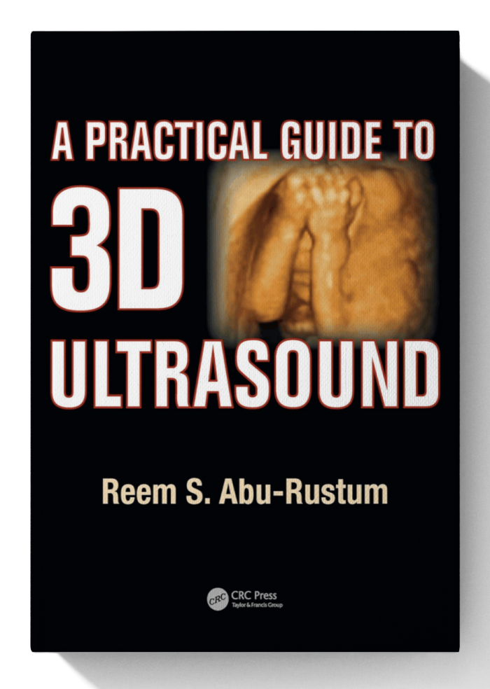 A Practical Guide to 3D Ultrasound