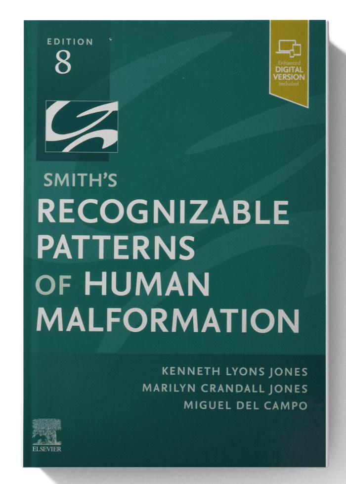 Smith's Recognizable Patterns of Human Malformation: Expert Consult