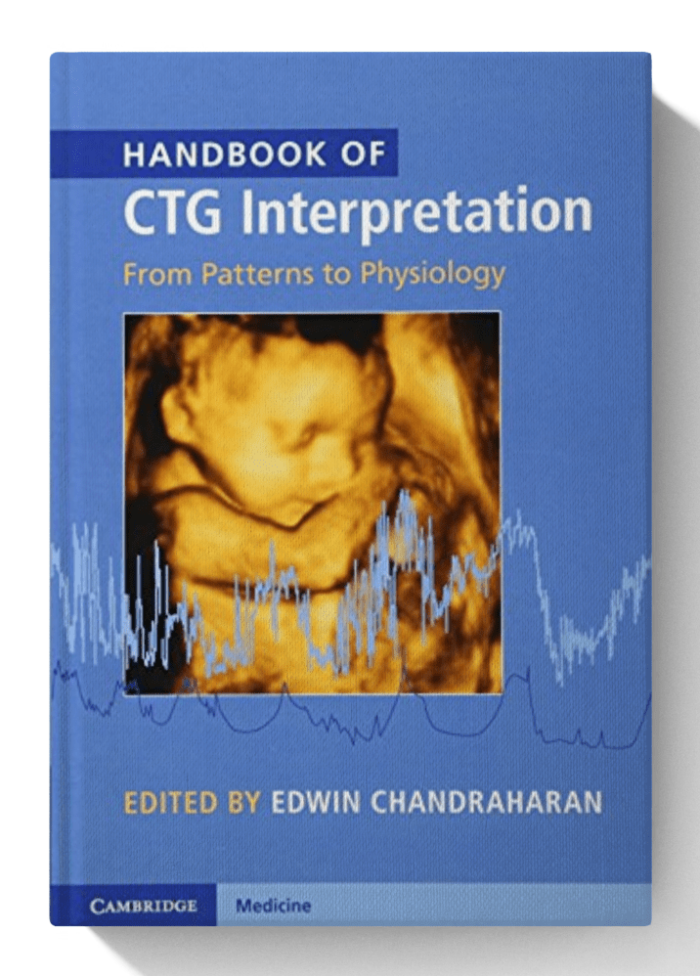 Handbook of CTG Interpretation: From Patterns to Physiology