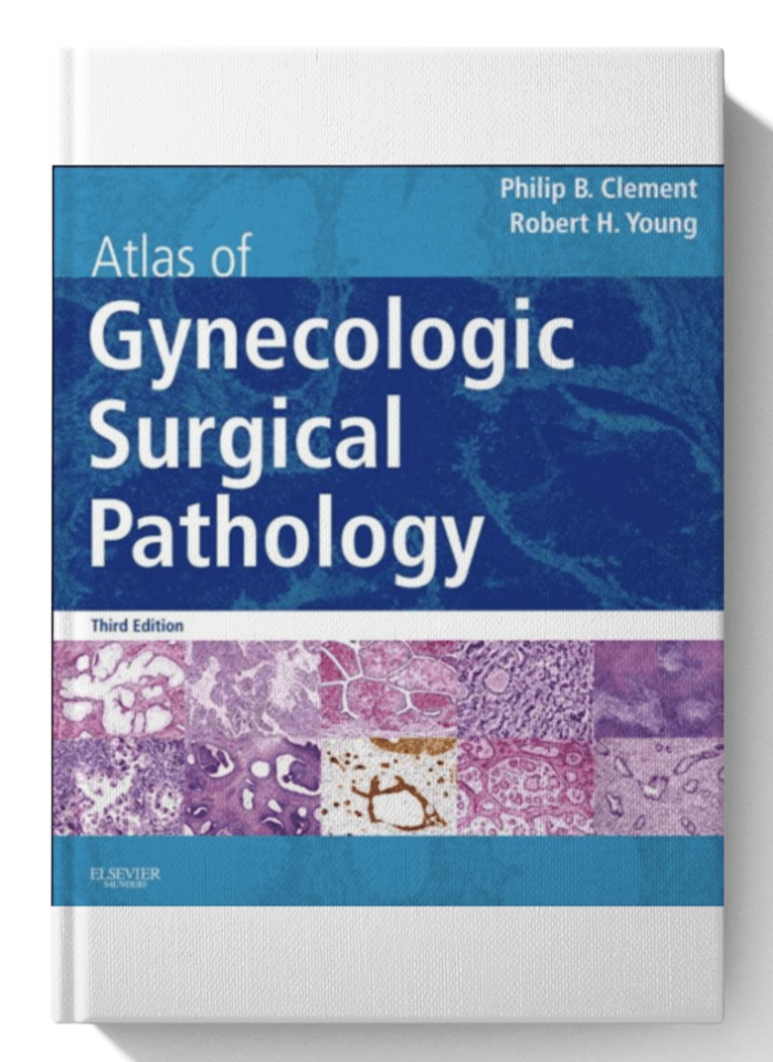 Atlas of Gynecologic Surgical Pathology: 3rd Edition