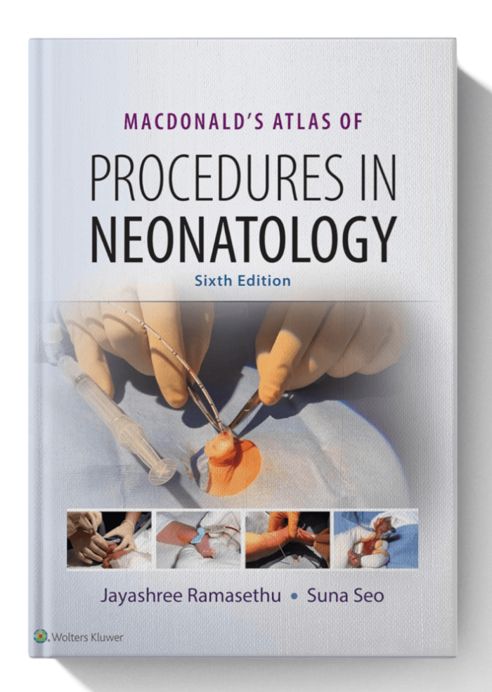 MacDonald's Atlas of Procedures in Neonatology 6th Edition