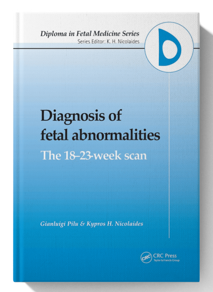 Diagnosis of fetal abnormalities : the 18-23-week scan