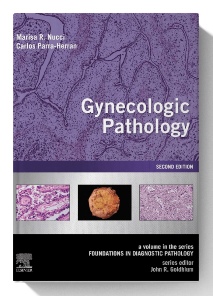 Gynecologic Pathology: A Volume in Foundations in Diagnostic Pathology Series 2nd Edition