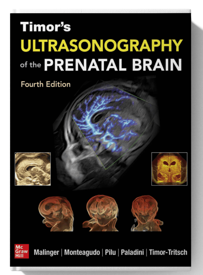 Timor's Ultrasonography of the Prenatal Brain (4th Edition)