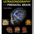 Timor's Ultrasonography of the Prenatal Brain (4th Edition)