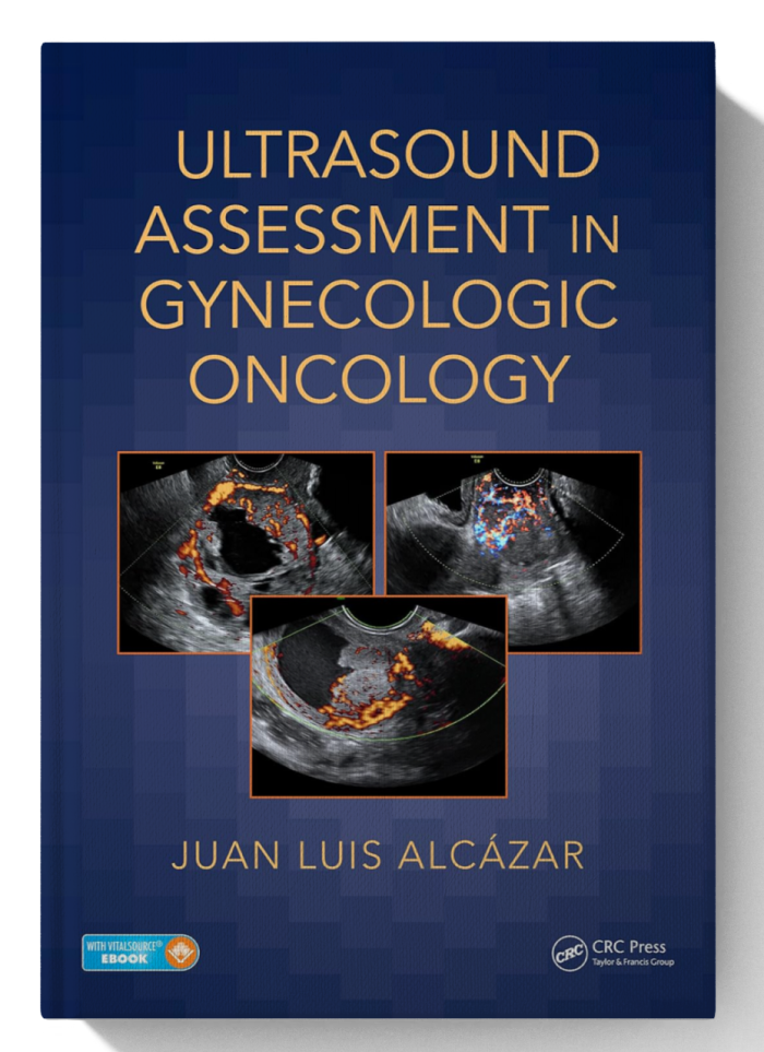 Ultrasound Assessment in Gynecologic Oncology (1st Edition)