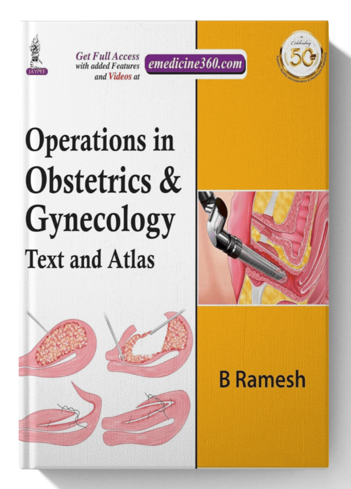 Operations in Obstetrics & Gynecology: Text And Atlas (1st Edition)