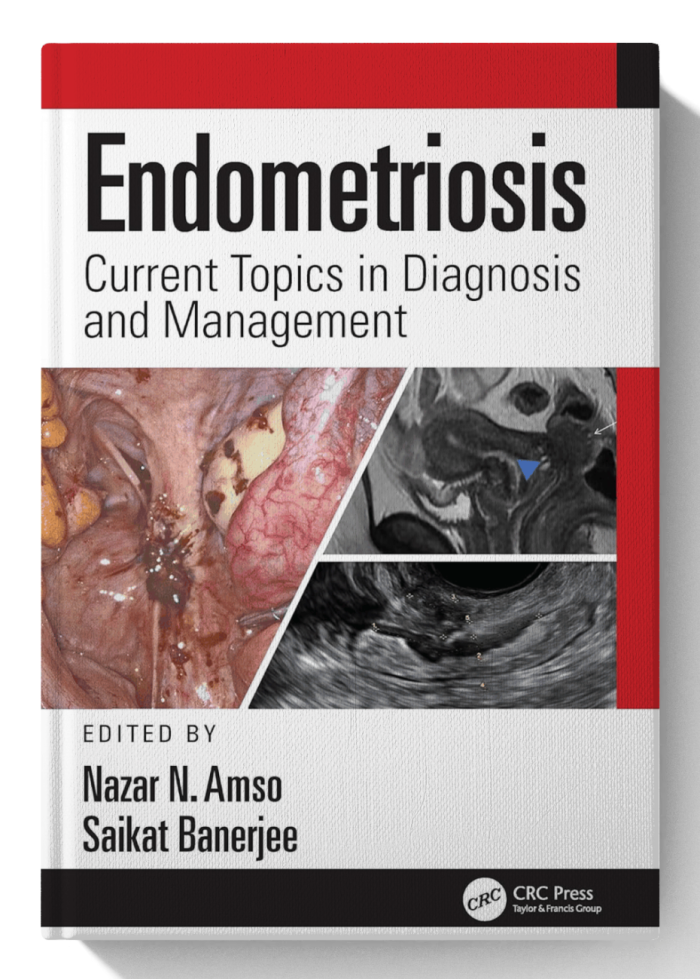 Endometriosis: Current Topics in Diagnosis and Management (1st Edition)