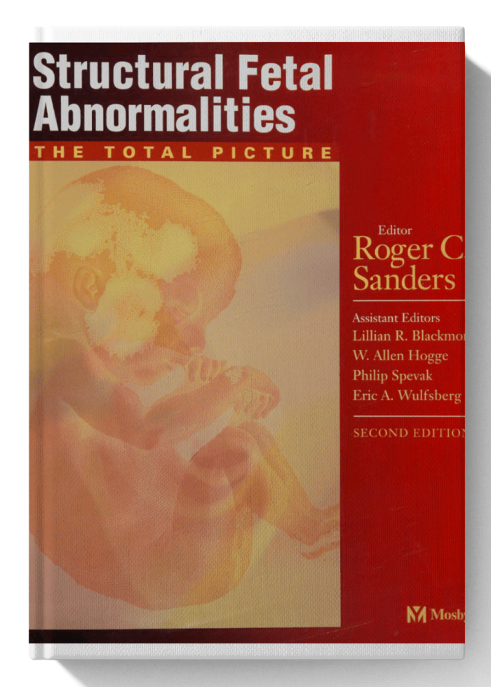 Structural Fetal Abnormalities: the Total Picture (2nd Edition)