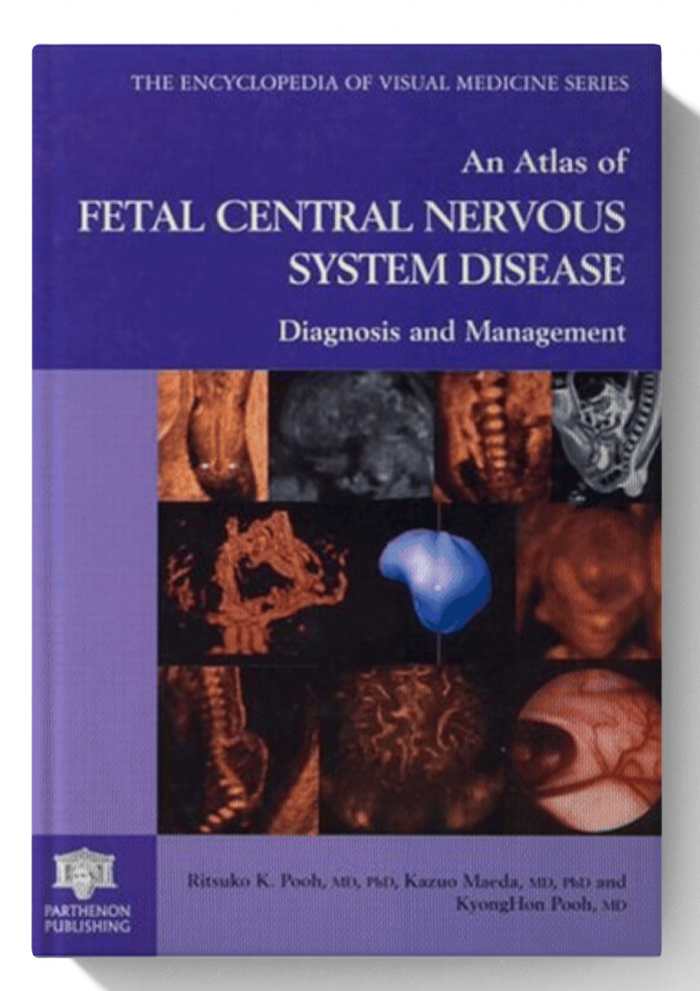 An Atlas of Fetal Central Nervous System Disease: Diagnosis and Management (Encyclopedia of Visual Medicine Series, 64)