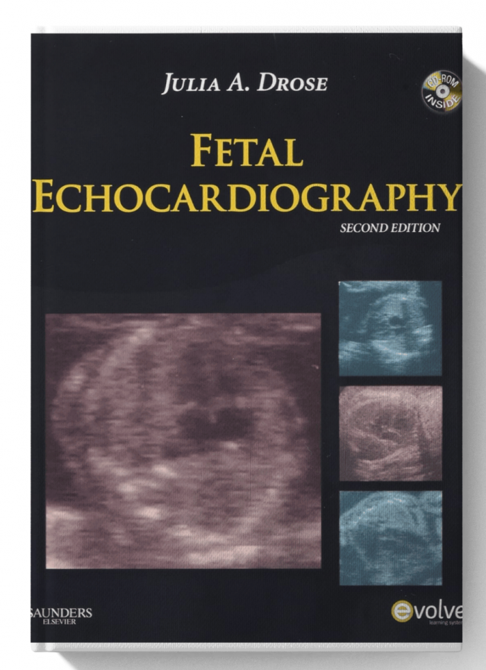 Fetal Echocardiography (2nd Edition)