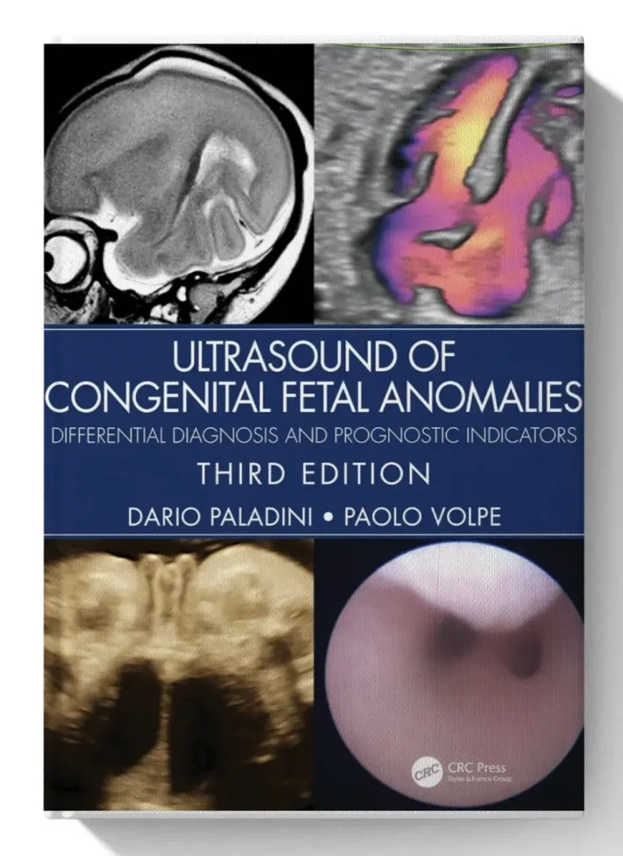 Ultrasound of Congenital Fetal Anomalies: Differential Diagnosis and Prognostic Indicators 3rd Edition