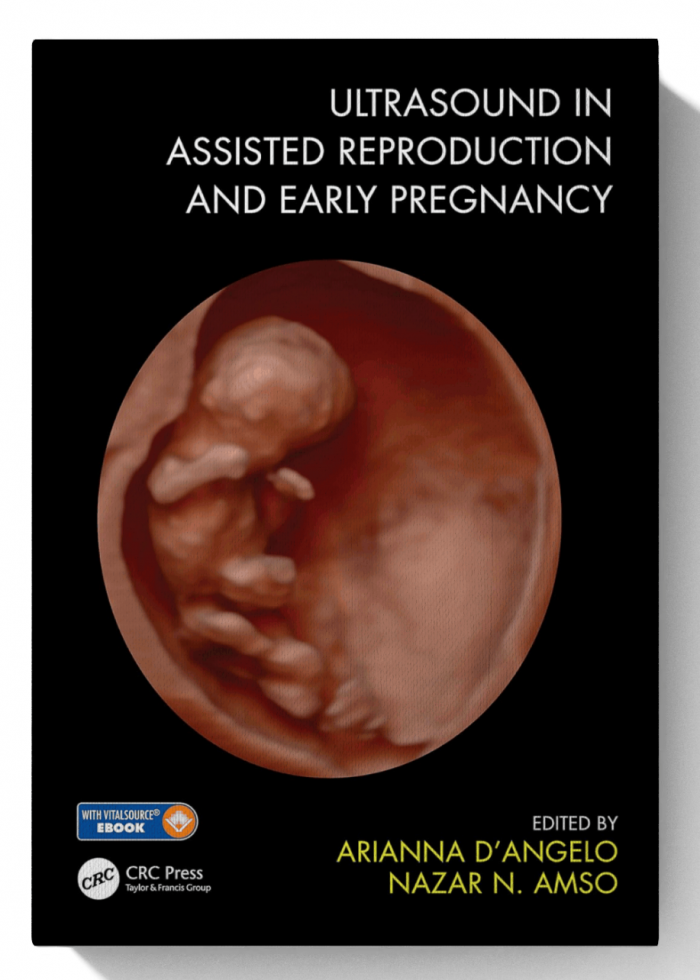 Ultrasound in Assisted Reproduction and Early Pregnancy (1st Edition)