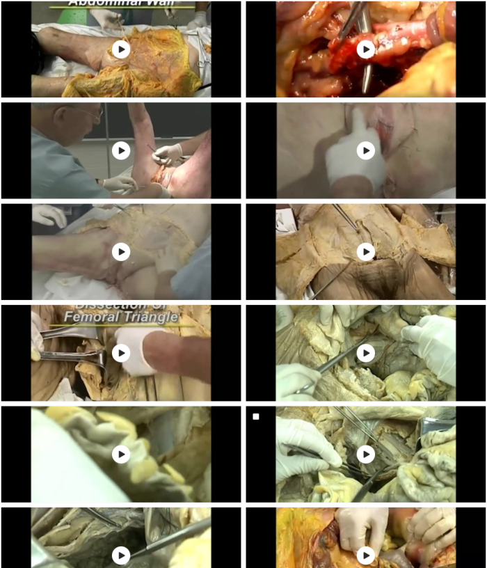 Atlas of Pelvic Anatomy and Gynecologic Surgery (Videos only) - Image 2