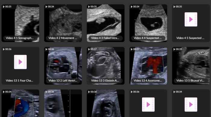 Callen's Ultrasonography in Obstetrics and Gynecology (Videos only) - Image 2