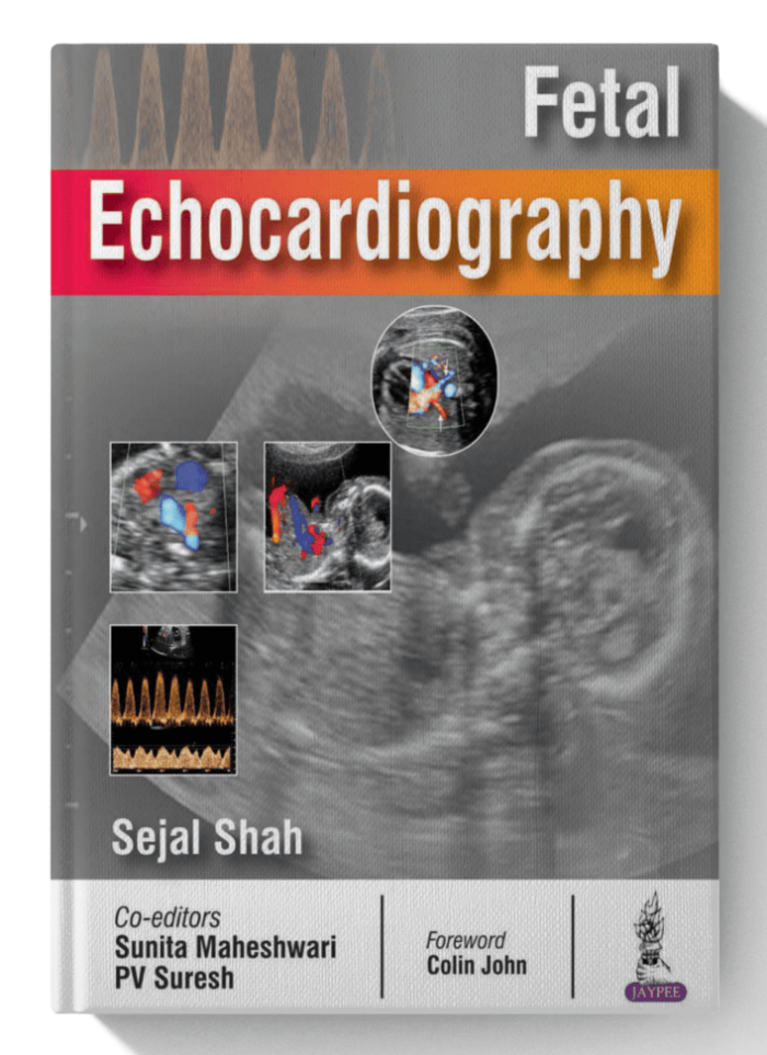 Fetal Echocardiography