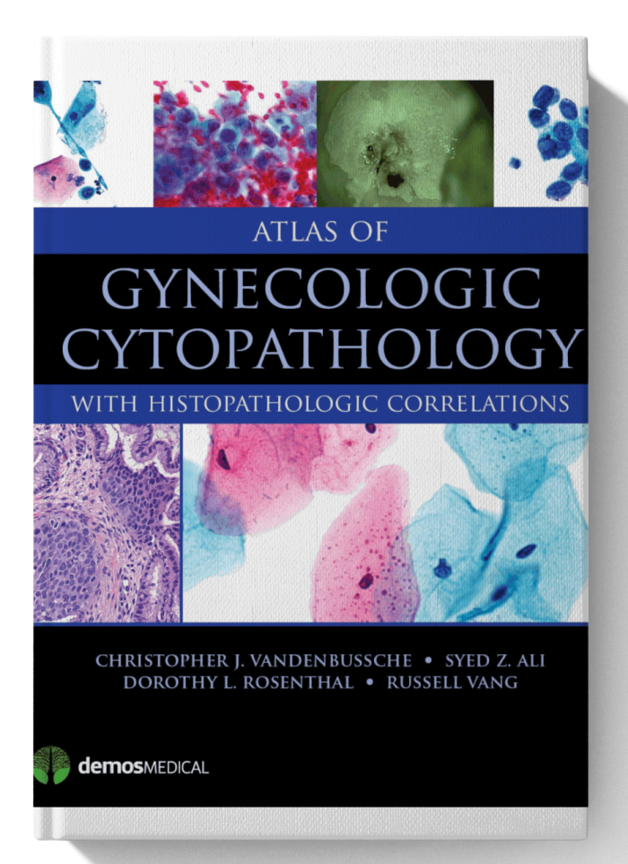 Atlas of Gynecologic Cytopathology: with Histopathologic Correlations (1st Edition)