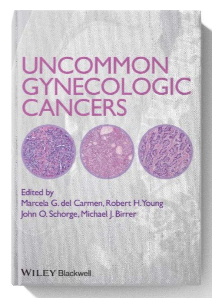 Uncommon Gynecologic Cancers (1st Edition)