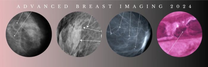 Advanced Breast Imaging 2024 – CMEScience (Videos)