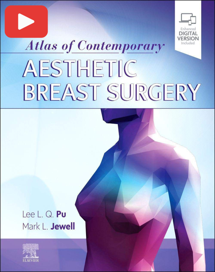 Atlas of Contemporary Aesthetic Breast Surgery: A Comprehensive Approach (Video only)