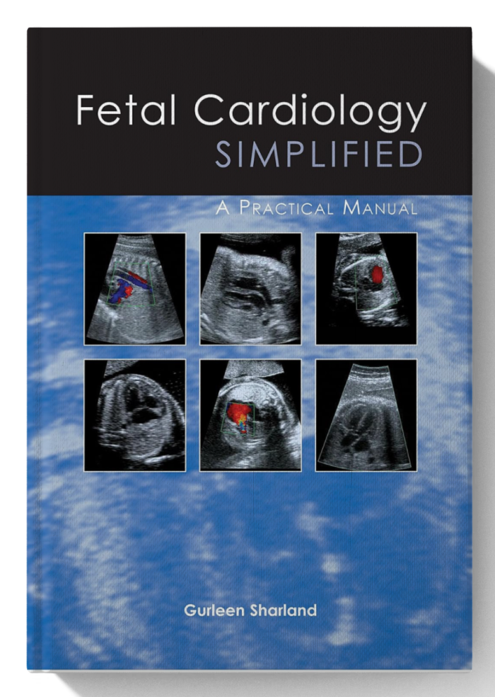 Fetal Cardiology Simplified: A Practical Manual (1st Edition)