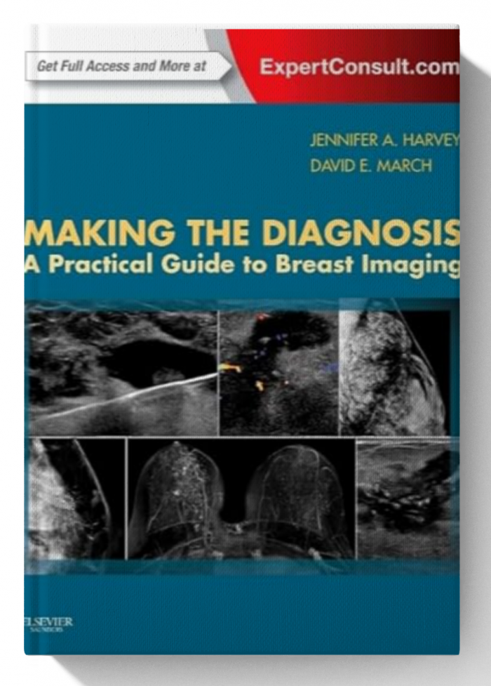 Making the Diagnosis: A Practical Guide to Breast Imaging: Expert Consult