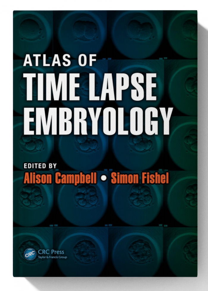 Atlas of Time Lapse Embryology (1st Edition)