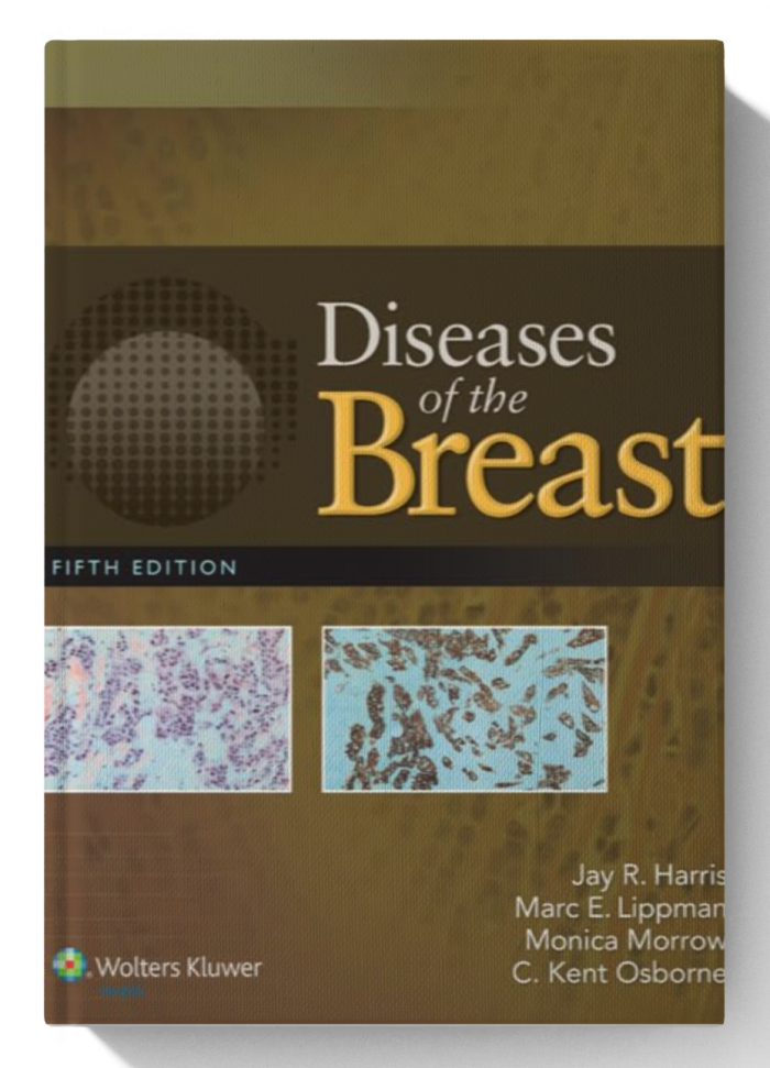 Diseases of the Breast (5th Edition)