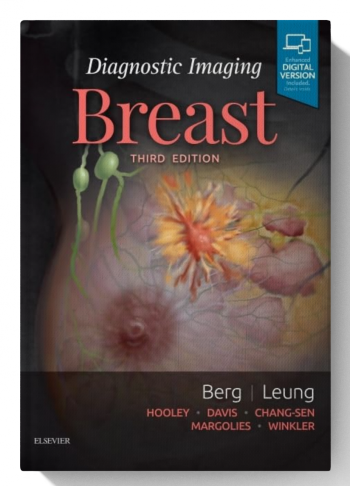 Diagnostic Imaging: Breast (3rd Edition)