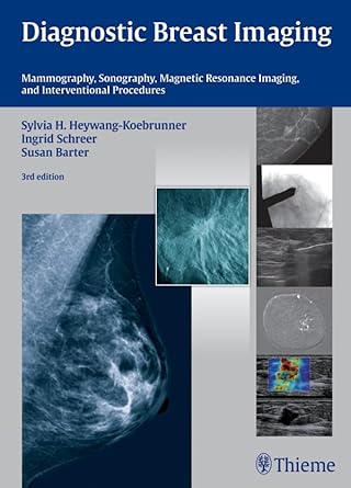 Diagnostic Breast Imaging: Mammography, Sonography, Magnetic Resonance Imaging, and Interventional Procedures