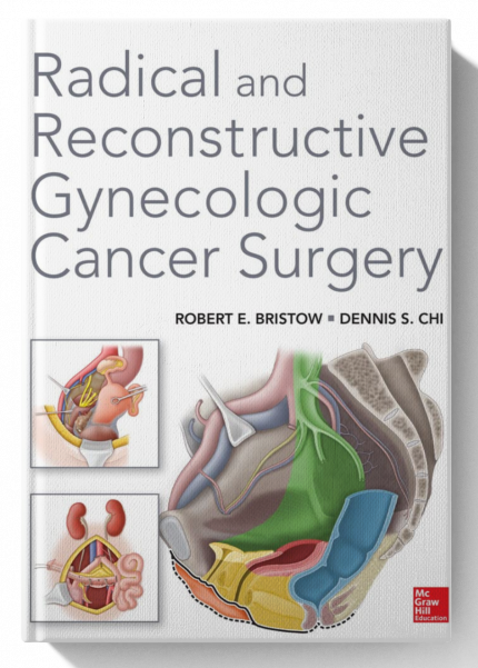 Radical and Reconstructive Gynecologic Cancer Surgery