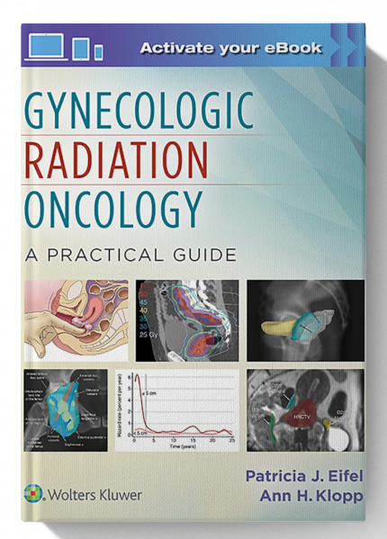 Gynecologic Radiation Oncology: A Practical Guide