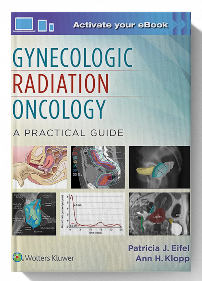 Gynecologic Radiation Oncology: A Practical Guide