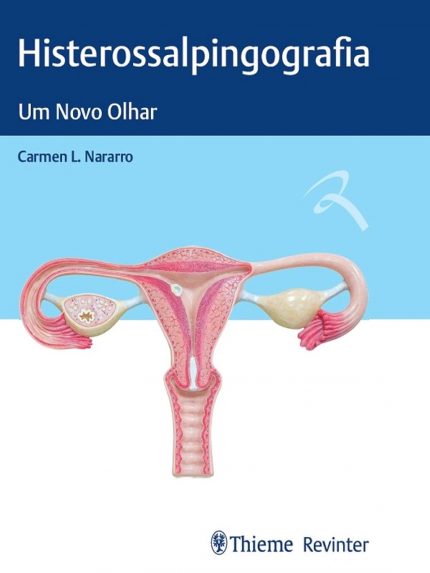 Histerossalpingografia: Um Novo Olhar (Portuguese Edition)