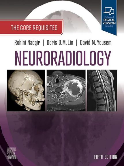 Neuroradiology: The Requisites E-Book: The Core Requisites