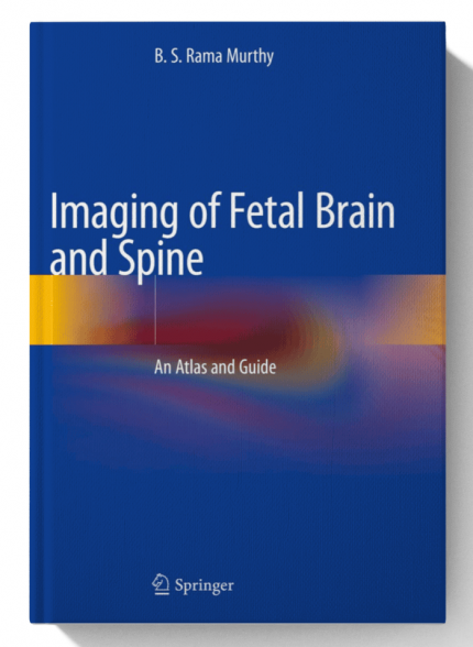Imaging of Fetal Brain and Spine : An Atlas and Guide