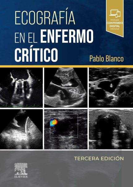 EcografÃa en el enfermo crÃtico, 3rd Edition (Original PDF from Publisher)